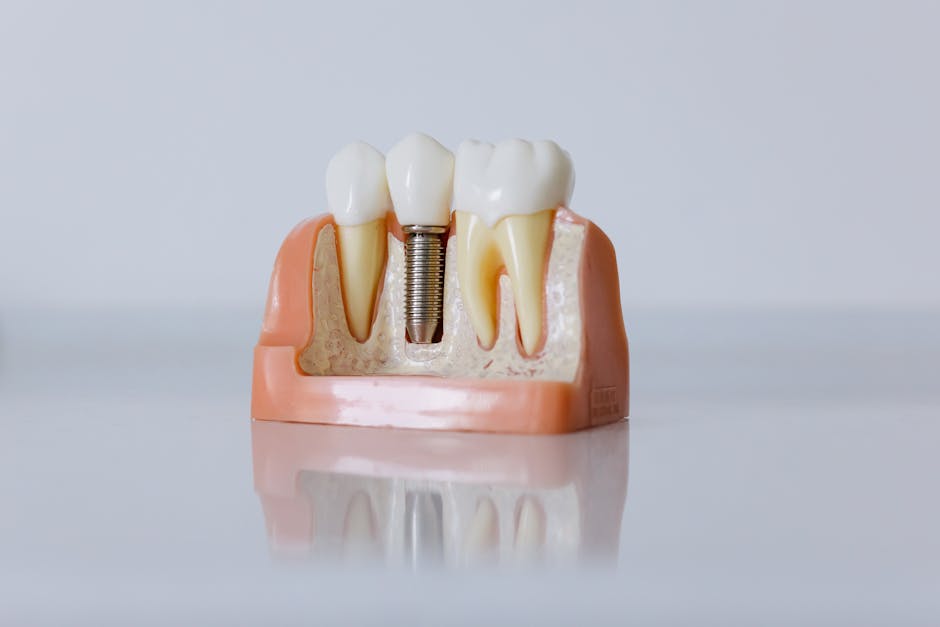 Dental implant model showing a replacement tooth in the jaw